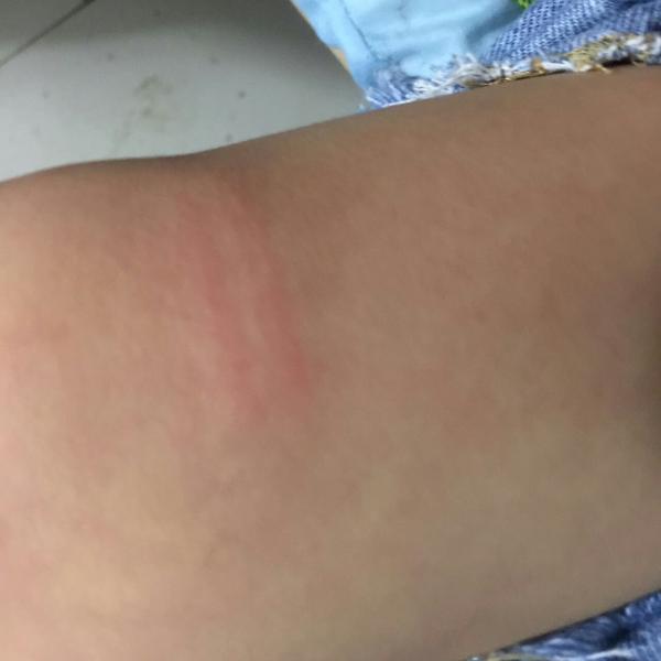 周周说:“膝盖上的两道红杠,是陆老师用棍敲打的。”