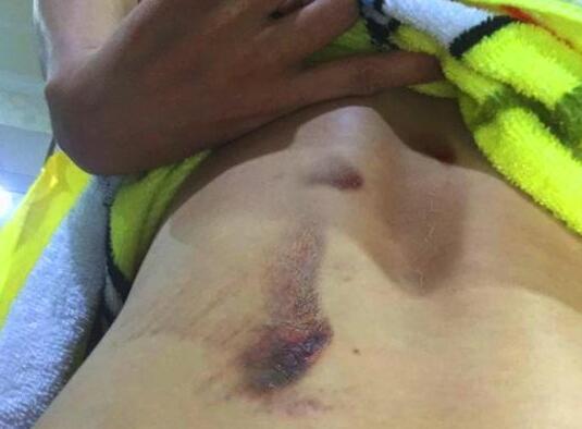 真相大白？有爆料称“坠崖G姓女星”原来是她