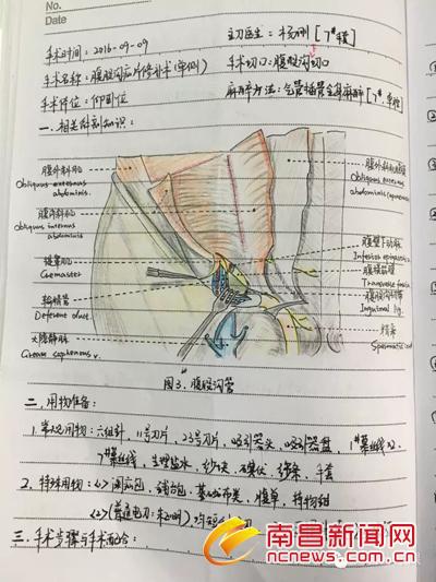 90后美女护士手术笔记走红 字迹工整解剖图手绘