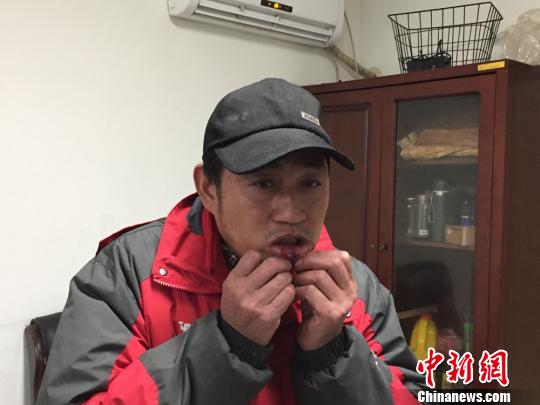 戴小虎展现伤口。 孙权 摄