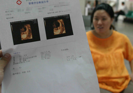 怀孕三个月彩超图片图片
