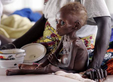 非洲穷人饿死的图片图片