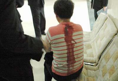 北京烟草执法人员被砍两刀 后背血迹近1米(图)