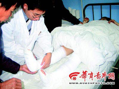 医生给胡建英包扎骨折的双腿 本报记者 赵云峰 摄