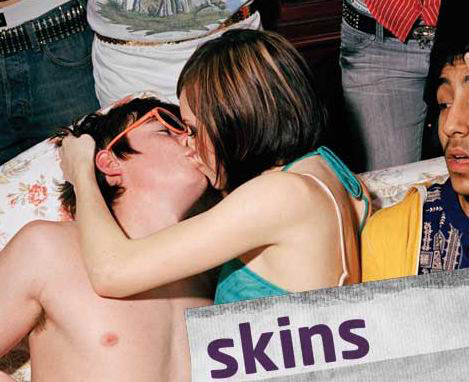 The skins