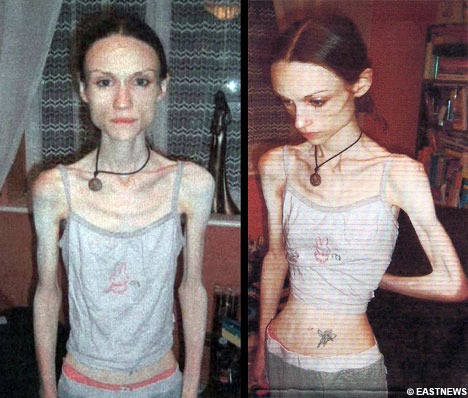 世界上最瘦的十个女人图片