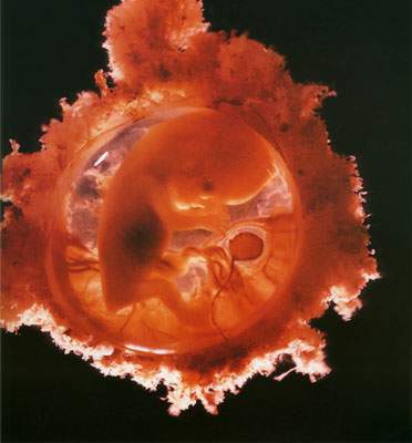 50天胎儿的样子图片图片