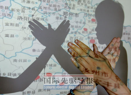 艾滋病人更需要关爱与尊重。