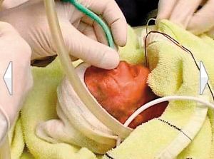 德国超级孕妇早产3个月 3分钟顺利产6胞胎(图)