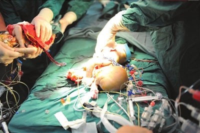 宝宝粘连分离手术图片图片