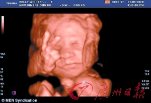 英一女子怀孕27周 胎儿摆出不雅手势(图)