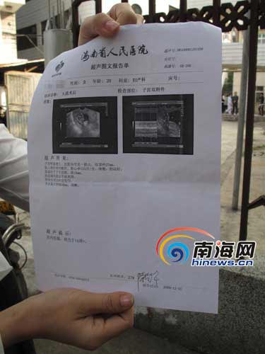 王小姐经过人流手术后,在12月1日的b超显示腹中婴儿还存在(南海网记者