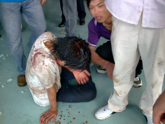 事故现场的伤者浑身是血 南方日报记者 丁玎 邓生