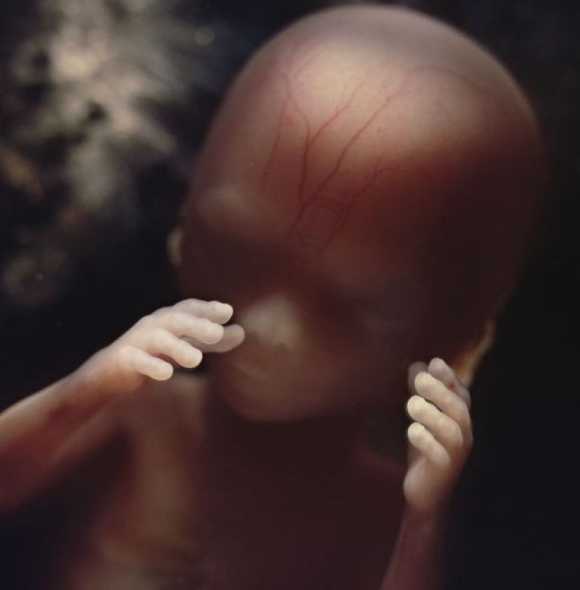 胎儿子宫内发育震撼照:10周大胎儿眼睑半闭(图)