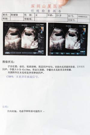彩超显示,陈丽敏腹中胎儿已死