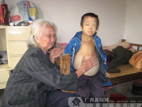 奶奶摸着左银华的“大肚子”，伤心地哭出声来。记者黄真真 摄
