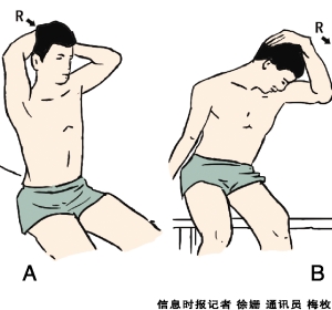 颈肌抗阻训练为"电脑脖"止痛