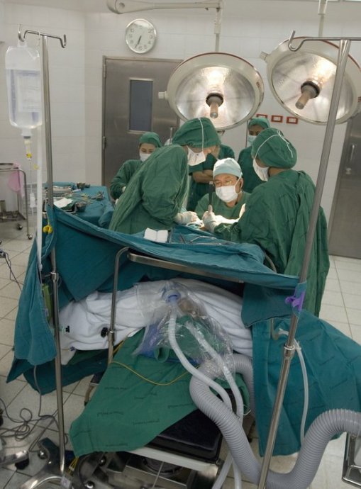变性手术3D 器官图片