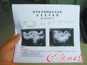 胎儿b超单图片