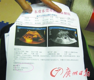怀孕b超单 早孕图片