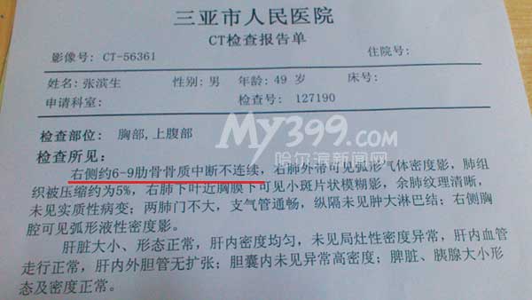 ct检查报告显示,张芊的父亲张滨生初步诊断右侧第6至9根肋骨骨折