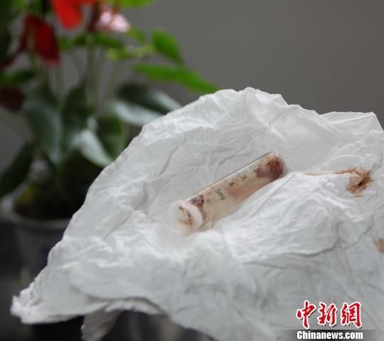 張華一個月前從口中吐出的注射器針筒,至今血跡斑斑. 劉良偉 攝