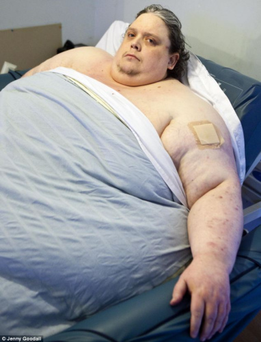全球最胖男子卧床11年没有出门 曾想过自杀(图)