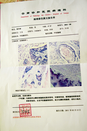 胃癌的诊断报告单图片图片