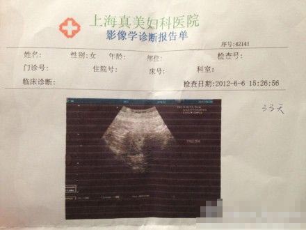 母豚鼠怀孕一个月图片图片