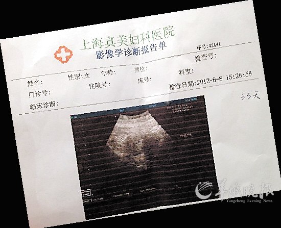 林博文在微博贴出胎儿b超照片