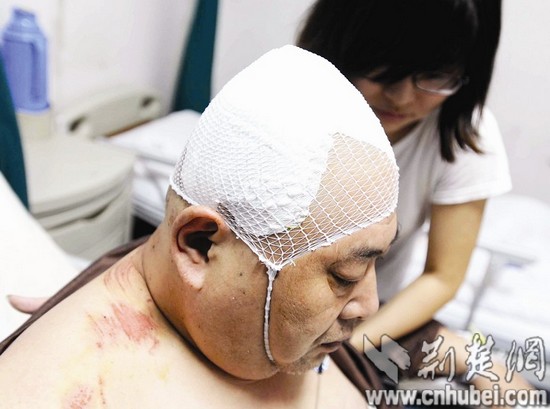 图为:贾先生头部受伤住院,幸无生命危险 (记者刘大家 实习生合欢摄)