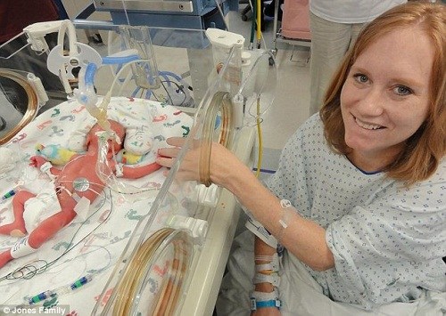 母亲凯莉诞下的五胞胎宝宝中,最轻的还不到05千克