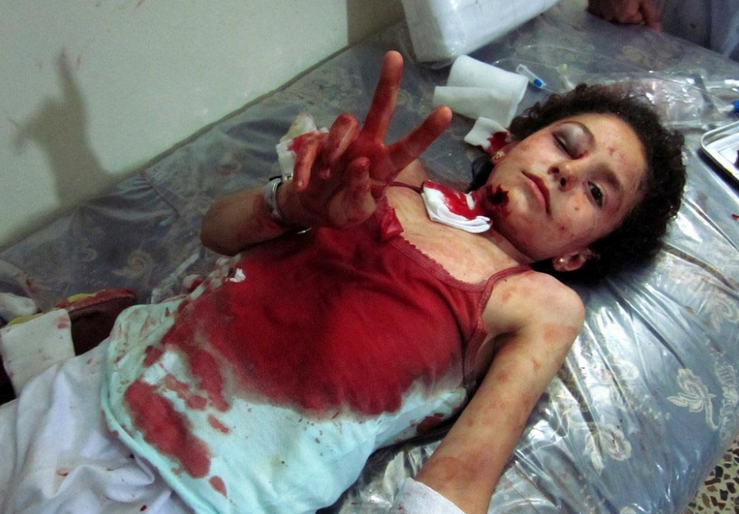 叙利亚战场女尸图片