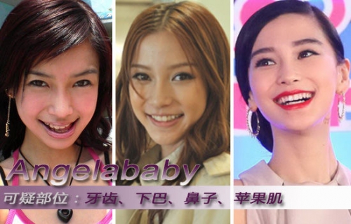 整形師曝鄭爽楊冪angelababy李小璐整容真相(圖)