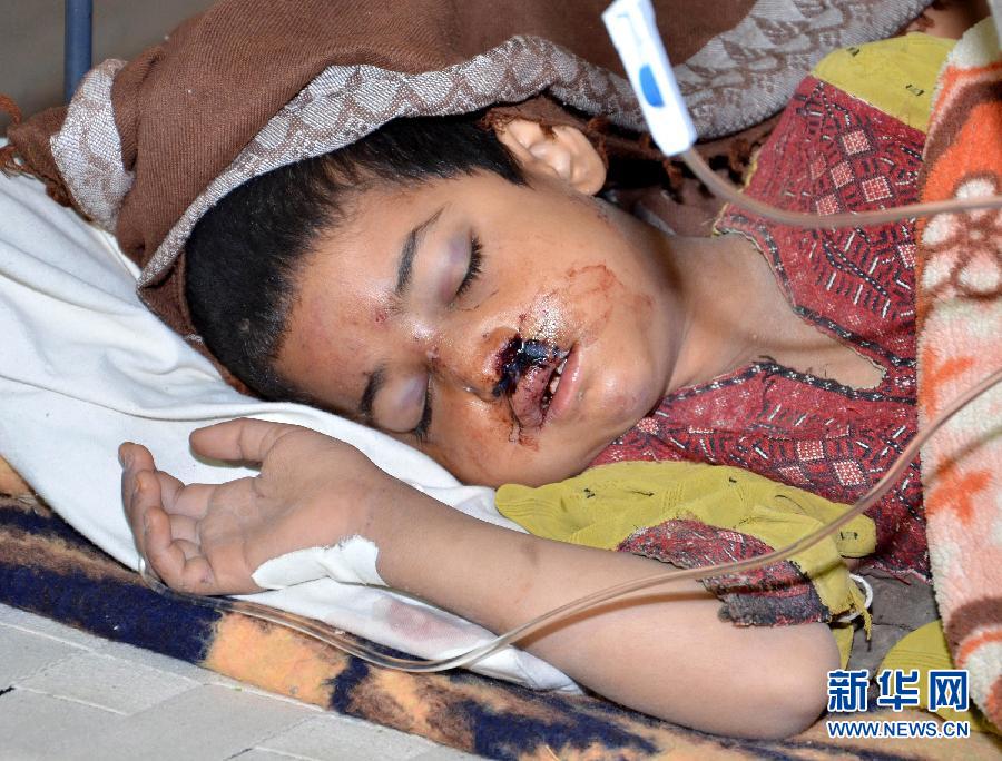 4月17日，在巴基斯坦马什盖尔地震灾区，一名地震中受伤的儿童在医院接受治疗。巴基斯坦官方18日表示，巴基斯坦地震灾区的救援工作正在加速进行。 新华社发（阿萨德摄）