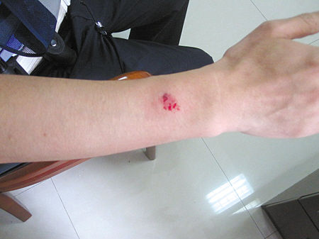 中年妇女机动车道骑电动车被拦 狠咬交警手腕