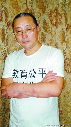 王功权被警方传唤审查 涉嫌扰乱公共场所秩序