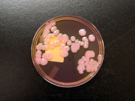 实验室显微镜下的抗碳青霉烯肠杆菌,其对最强的抗菌素也有抵抗性