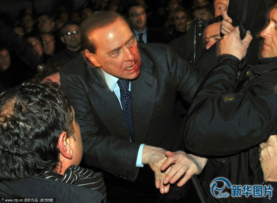 2009年12月13日，意大利总理贝卢斯科尼受邀在米兰参加一个集会时遭到袭击，面部受伤流血，随后被紧急送医治疗。