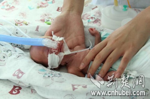 29岁年轻妈妈产下750克男婴 获好心人捐32万救命款_荆楚网