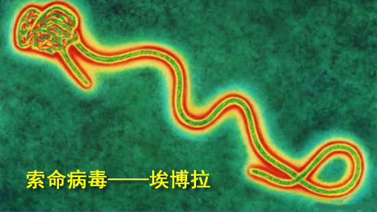 埃博拉病毒图片资料图片