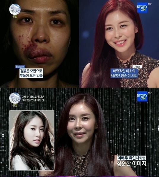 韩国女星整容失败图片