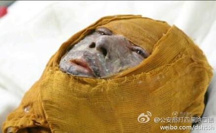 中国人体自燃图片