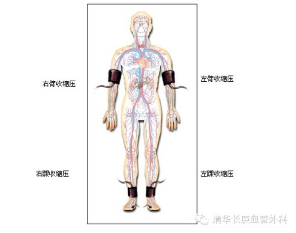 踝肱指数图片