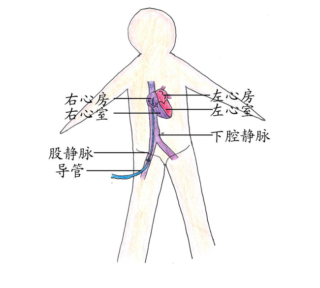 股静脉穿刺定位图解图片