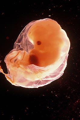怀孕70天胚胎图片高清图片
