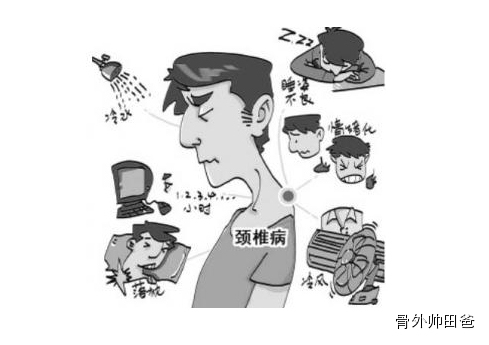 低头族不能言说的痛——颈椎病