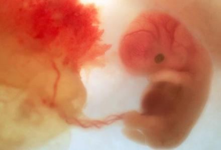 怀胎十月:来了解胎儿发育全过程吧