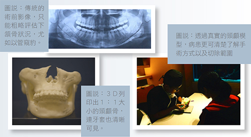 傳統的削骨手術,術前需要拍攝x光片及電腦斷層,藉由這些影像協助,可以