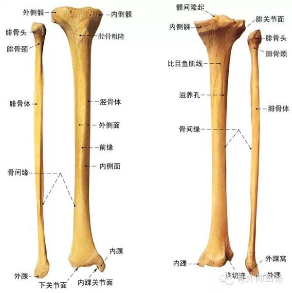 胫骨中下1/3处形态转变,易于骨折;胫骨上1/3骨折移位,易压迫腘动脉